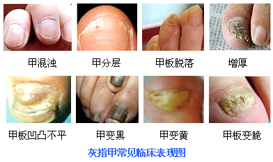 ���ݱ���Ƥ����