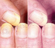 ���ݱ���Ƥ����