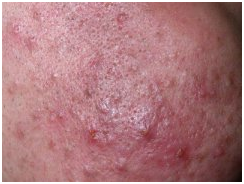 ���ݱ���Ƥ����