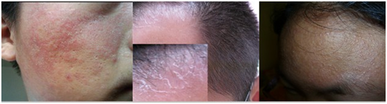 ���ݱ���Ƥ����