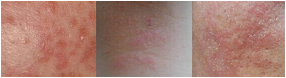 ���ݱ���Ƥ����