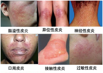 ���ݱ���Ƥ����