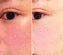 ���ݱ���Ƥ����