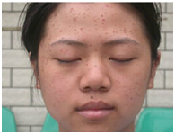 ���ݱ���Ƥ����