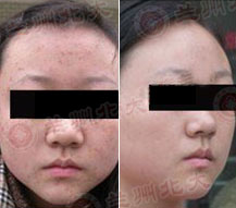 ���ݱ���Ƥ����