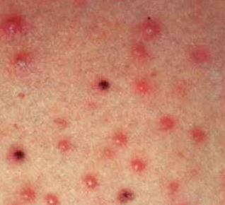 ���ݱ���Ƥ����