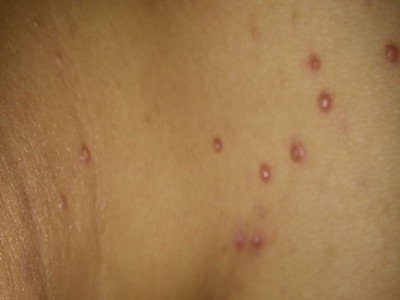 ���ݱ���Ƥ����