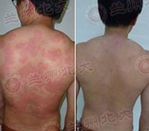 ���ݱ���Ƥ����