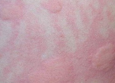 ���ݱ���Ƥ����