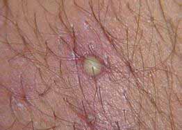 ���ݱ���Ƥ����