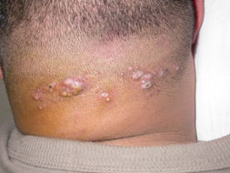 ���ݱ���Ƥ����