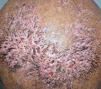 ���ݱ���Ƥ����