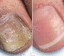 ���ݱ���Ƥ����