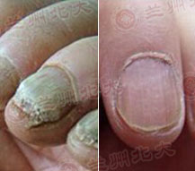 ���ݱ���Ƥ����