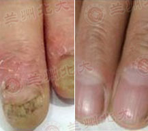 ���ݱ���Ƥ����