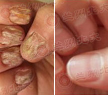 ���ݱ���Ƥ����