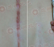 ���ݱ���Ƥ����