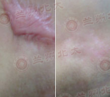 ���ݱ���Ƥ����