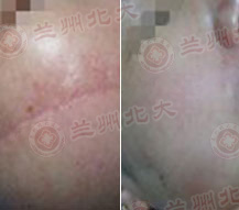 ���ݱ���Ƥ����