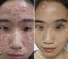 ���ݱ���Ƥ����