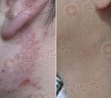 ���ݱ���Ƥ����