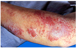 ���ݱ���Ƥ����