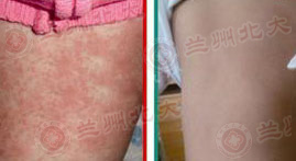 ���ݱ���Ƥ����