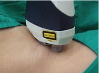 ���ݱ���Ƥ����