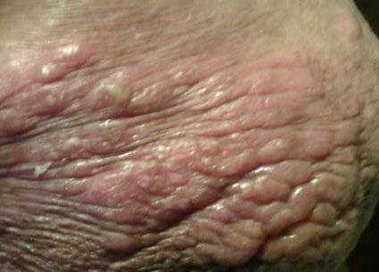 ���ݱ���Ƥ����