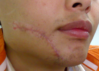 ���ݱ���Ƥ����