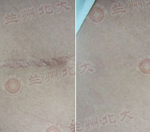 ���ݱ���Ƥ����