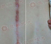 ���ݱ���Ƥ����