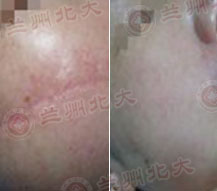 ���ݱ���Ƥ����