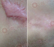 ���ݱ���Ƥ����