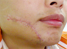 ���ݱ���Ƥ����