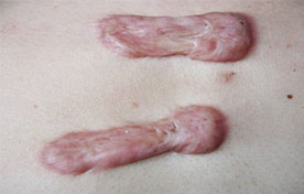 ���ݱ���Ƥ����