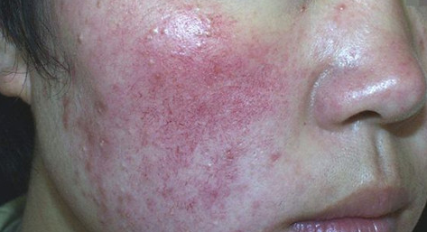 ���ݱ���Ƥ����