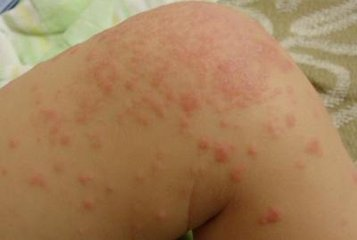 ���ݱ���Ƥ����