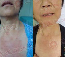 ���ݱ���Ƥ����