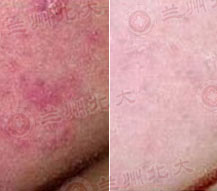 ���ݱ���Ƥ����