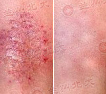 ���ݱ���Ƥ����