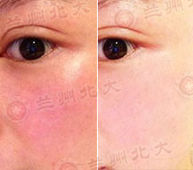 ���ݱ���Ƥ����