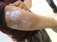 ���ݱ���Ƥ����