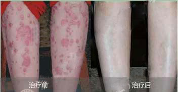 ���ݱ���Ƥ����