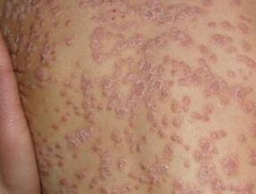 ���ݱ���Ƥ����