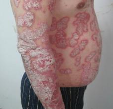 ���ݱ���Ƥ����