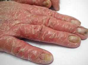 ���ݱ���Ƥ����