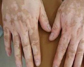 ���ݱ���Ƥ����