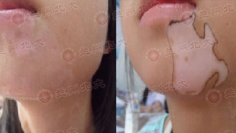 ���ݱ���Ƥ����