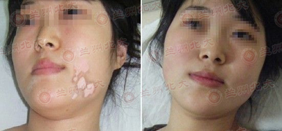 ���ݱ���Ƥ����